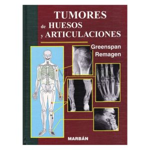 Tumores de huesos y articulaciones