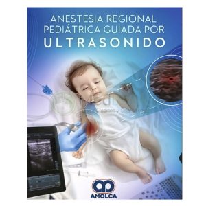 Anestesia regional pediátrica guiada por ultrasonido