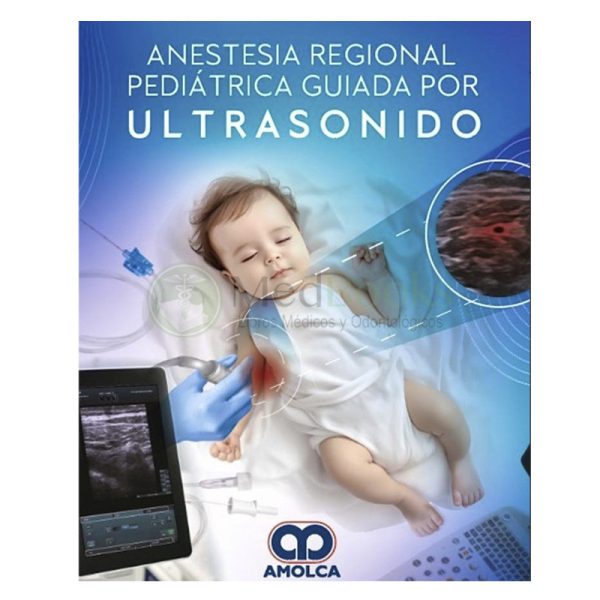 Anestesia regional pediátrica guiada por ultrasonido
