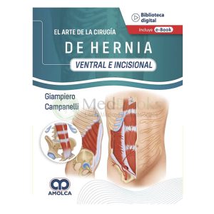 El arte de la Cirugía de la Hernia - Ventral e Incisional