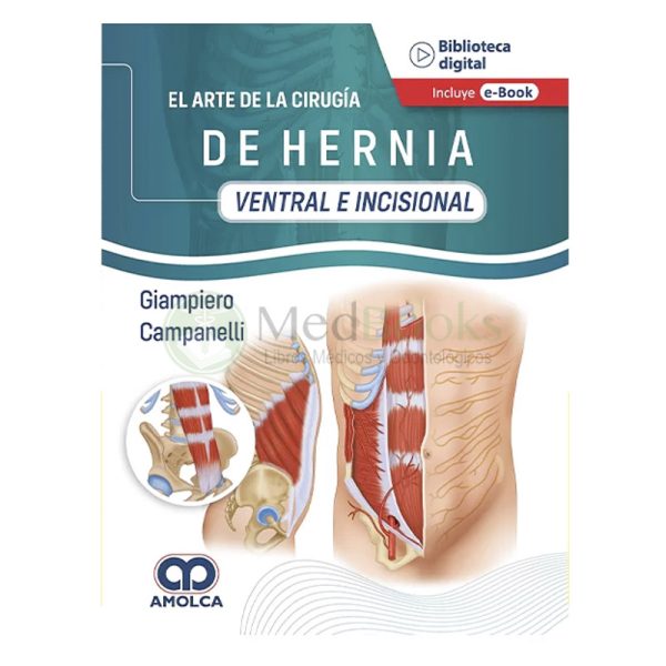 El arte de la Cirugía de la Hernia - Ventral e Incisional