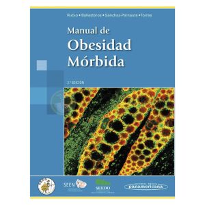 Manual de Obesidad Mórbida 2ª Ed.