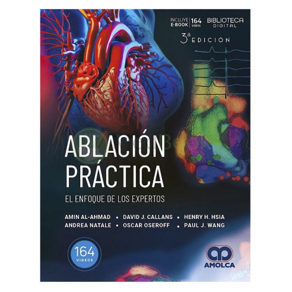 Ablación Práctica. El Enfoque de los Expertos