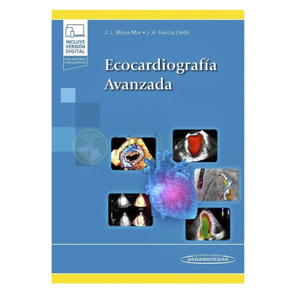 Ecocardiografía avanzada