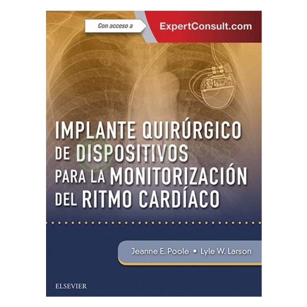 Implantes Quirúrgicos de Dispositivos Monitorización del Ritmo Cardíaco