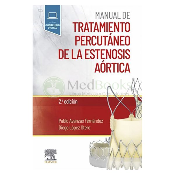 Manual de tratamiento percutáneo de la estenosis aórtica 2ª Ed.