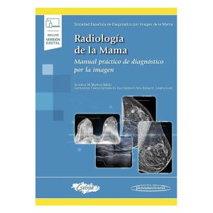 Radiología de la mama. Manual practico de diagnostico