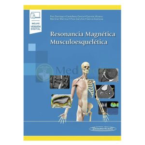 Resonancia magnética musculoesquelética