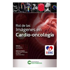 Rol de las imágenes en cardio-oncología