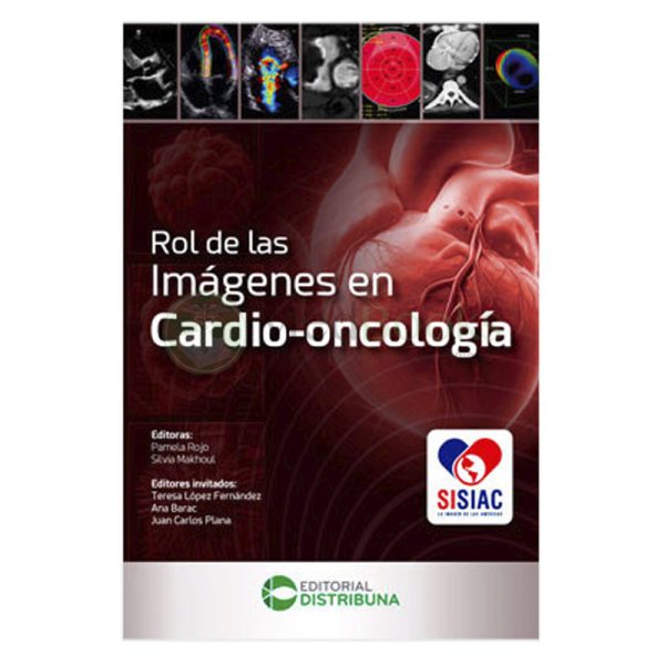 Rol de las imágenes en cardio-oncología