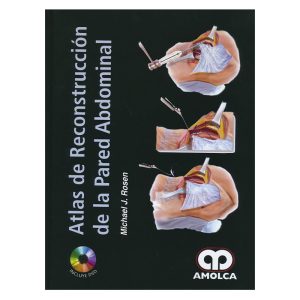 Atlas de Reconstrucción de la Pared Abdominal
