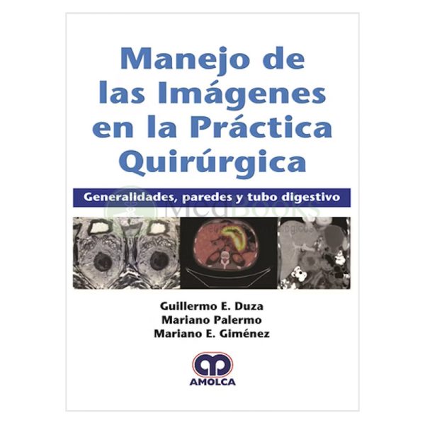 Manejo de las Imágenes en la Práctica Quirúrgica. Generalidades, Paredes y Tubo Digestivo