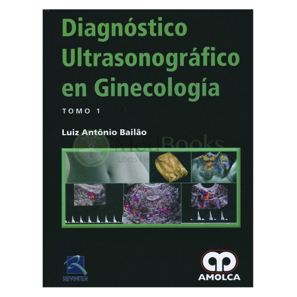 Diagnostico Ultrasonografico en Ginecologia, 2 Vols.