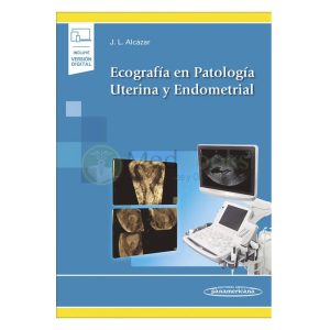 Ecografía en patología uterina y endometrial