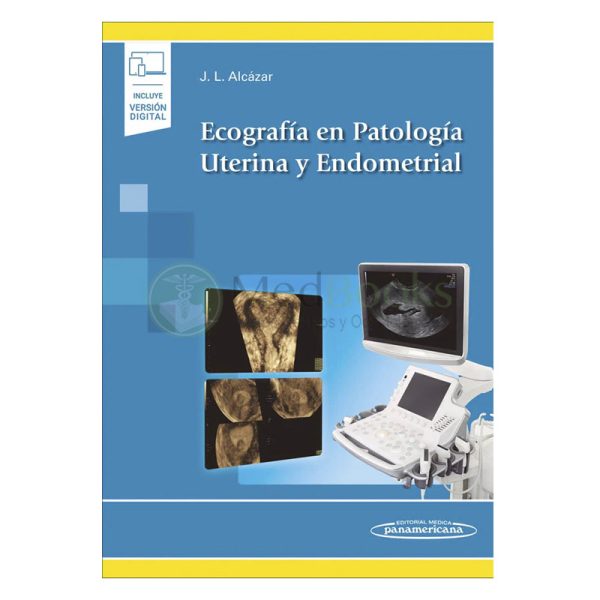 Ecografía en patología uterina y endometrial