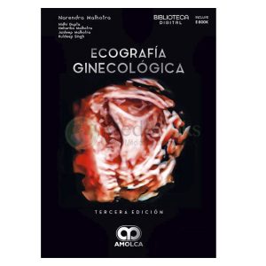 Ecografía ginecológica