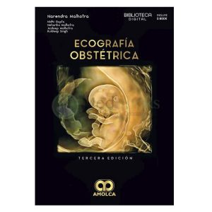 Ecografía obstétrica