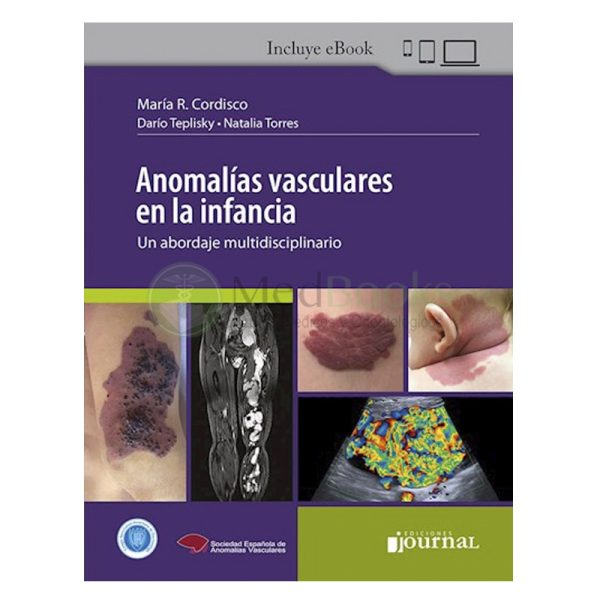 Anomalías Vasculares en la Infancia (eBook)