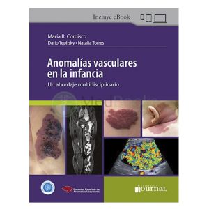 Anomalías Vasculares en la Infancia