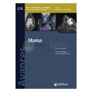 Avances en Diagnóstico por Imágenes: Mama (eBook)