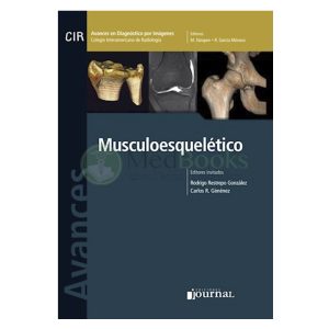 Avances en Diagnóstico por Imágenes: Musculoesquelético (eBook)