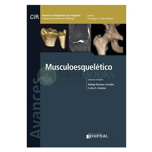 Avances en Diagnóstico por Imágenes: Musculoesquelético (eBook)