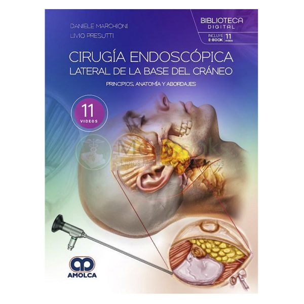 Cirugía Endoscópica Lateral de la Base del Cráneo. Principios, Anatomía y Abordajes