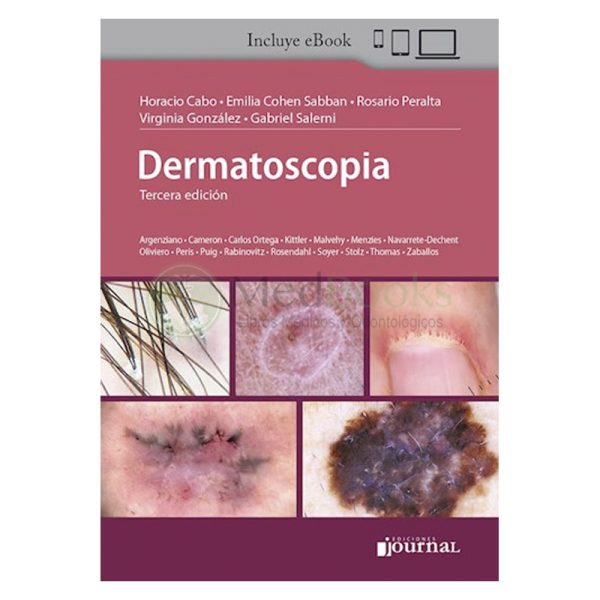 Dermatoscopia Ed.3