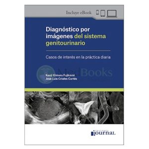 Diagnóstico por imágenes del sistema genitourinario (eBook)
