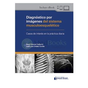 Diagnóstico por imágenes del sistema musculoesquelético (eBook)