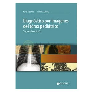 Diagnóstico por imágenes del tórax pediátrico Ed.2 (eBook)