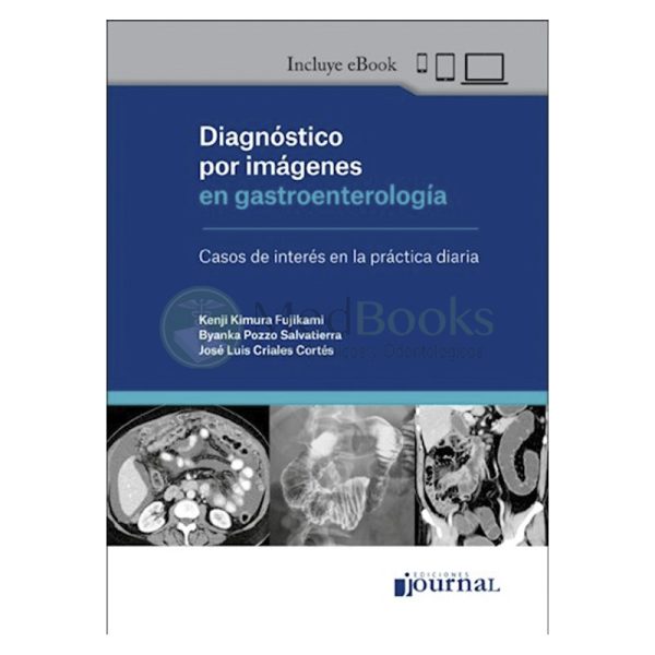 Diagnóstico por imágenes en gastroenterología (eBook)