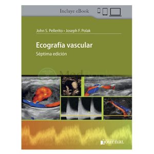 Ecografía Vascular Ed.7 (eBook)