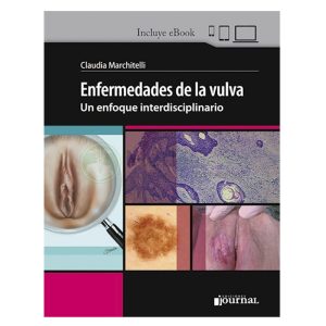 Enfermedades de la vulva