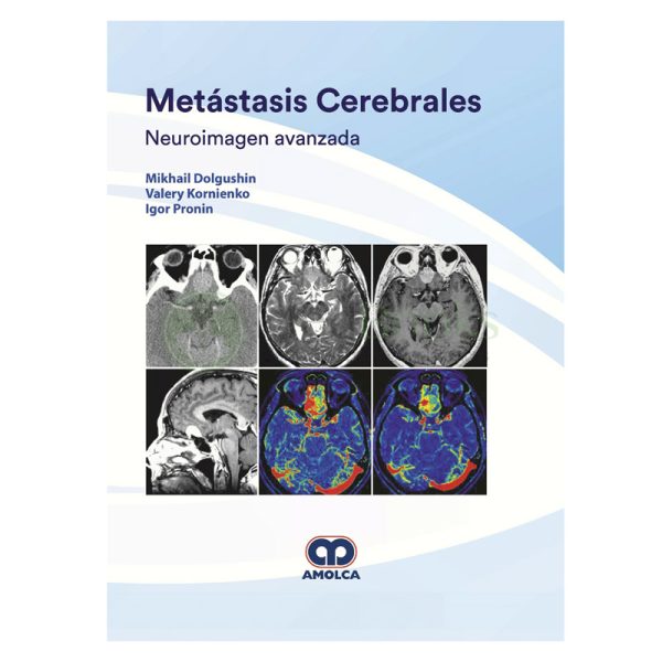 Metástasis Cerebrales. Neuroimagen Avanzada