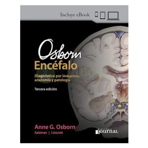 Osborn. El Encéfalo Ed.3 (eBook)