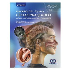 Rinorrea del Líquido Cefalorraquídeo. Guía Completa de Evaluación y Tratamiento
