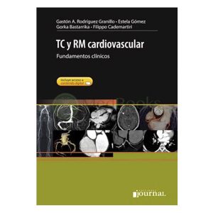 TC y RM cardiovascular (eBook)