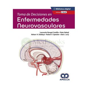 Toma de Decisiones en Enfermedades Neurovasculares