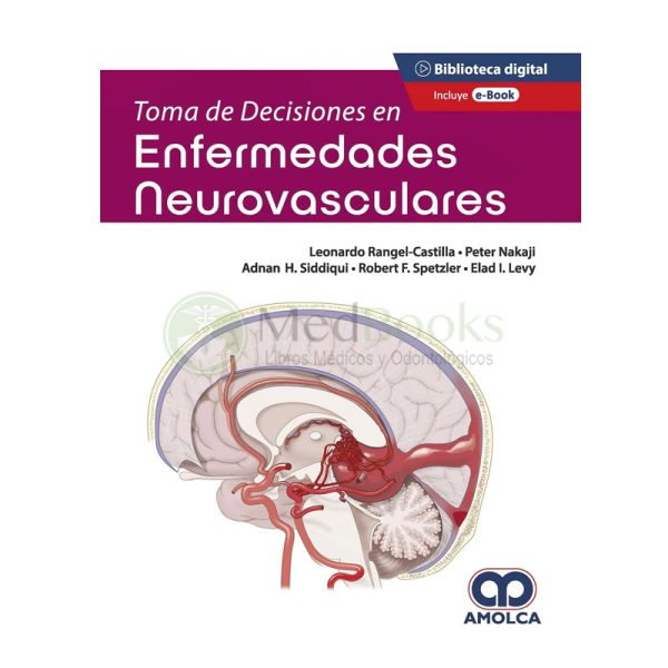 Toma de Decisiones en Enfermedades Neurovasculares