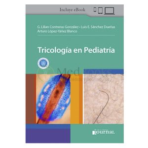 Tricología en Pediatría