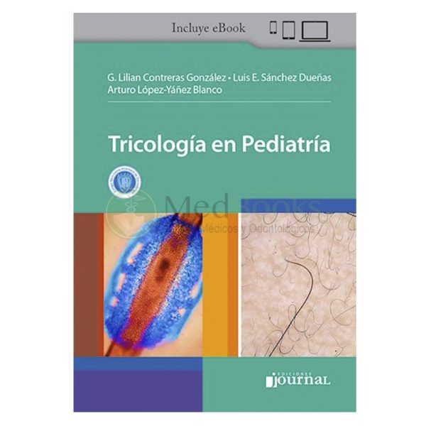 Tricología en Pediatría