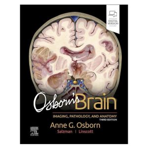 OSBORN's Brain. Imaging, Pathology, and Anatomy