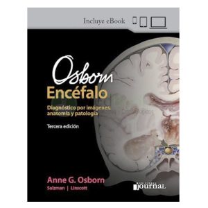 OSBORN's Brain. Imaging, Pathology, and Anatomy