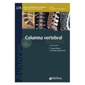 Avances en Diagnóstico por Imágenes: Columna vertebral (eBook)