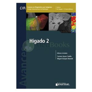 Avances en Diagnóstico por Imágenes: Hígado 2 (eBook)
