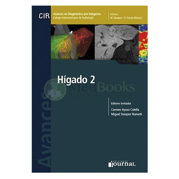 Avances en Diagnóstico por Imágenes: Hígado 2 (eBook)