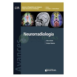 Avances en Diagnóstico por Imágenes: Neurorradiología (eBook)
