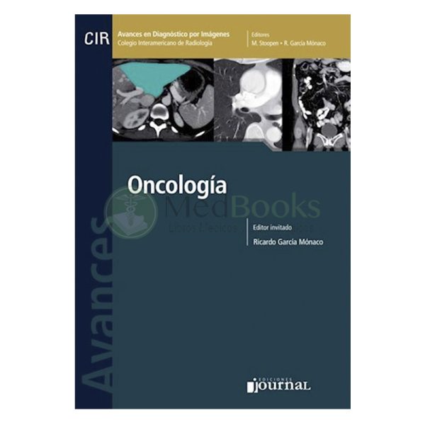 Avances en Diagnóstico por Imágenes: Oncología (eBook)
