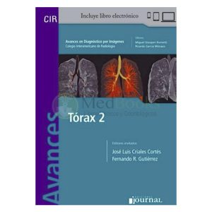 Avances en Diagnóstico por Imágenes: Tórax 2 (eBook)